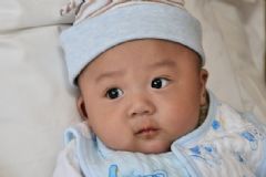 口腔念珠菌感染怎么治療？口腔念珠菌病的治療方法有哪些？[圖]