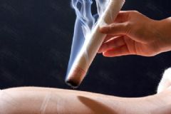 艾灸要注意哪些事項？艾灸的注意事項和禁忌？[圖]