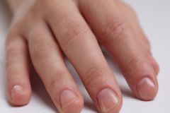 女生手粗糙怎么辦？女生手粗糙怎么保養(yǎng)？[多圖]
