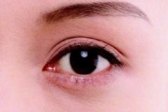 眼睛激光手術(shù)后注意什么？眼睛激光手術(shù)后怎么保養(yǎng)？[圖]