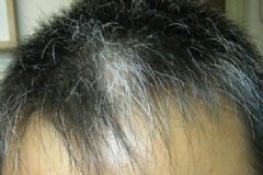 中學(xué)生長白頭發(fā)怎么辦？吃什么能讓頭發(fā)變黑？[多圖]