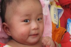 蚊子老咬寶寶怎么辦？蚊子喜歡叮咬寶寶怎么解決？[多圖]