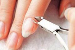 手指長倒刺是什么原因？手指起倒刺怎么回事？[圖]