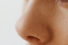 鼻竇炎是怎么引起的？鼻竇炎是什么原因引起的？[圖]