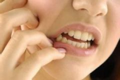 牙齒酸痛是什么原因？牙齒酸痛是怎么回事？[圖]