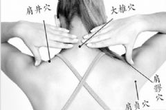 肩部拔罐的位置有哪些？肩部拔罐穴位[圖]