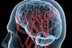 腦血管病的早期癥狀有哪些？腦血管疾病有什么癥狀？[圖]