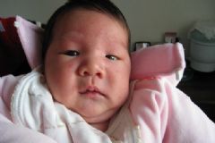 寶寶濕疹起皮屑怎么辦？寶寶濕疹起皮了怎么辦？[圖]