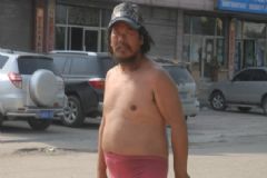 陰囊瘙癢是怎么回事？陰囊瘙癢該怎么辦？[多圖]