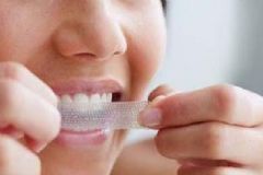 貼牙貼后要注意什么？牙貼使用注意事項(xiàng)[圖]