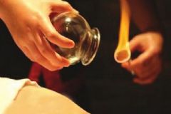 拔罐減肥會(huì)影響月經(jīng)嗎？拔罐會(huì)影響月經(jīng)推遲嗎？[圖]