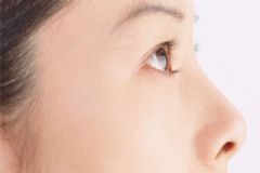 紅眼病不能吃什么東西？紅眼病不能吃哪些東西？[圖]