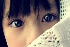 為什么會得紅眼??？怎么預(yù)防紅眼病呢？[圖]