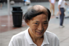 男人脫發(fā)的主要原因是什么？男人脫發(fā)怎么治療？[多圖]