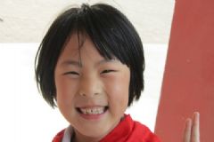 兒童牙髓炎影響換牙嗎？?jī)和浪柩自趺粗委熀?？[多圖]