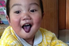 先天性心臟病的表現(xiàn)有哪些？先天性心臟病有哪些癥狀？[圖]