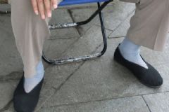 糖尿病爛腿怎么治療？糖尿病爛腿怎么預(yù)防？[圖]