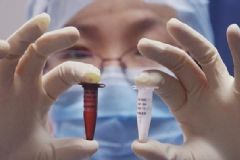 我國寨卡病毒疫情 寨卡病毒會導致死亡嗎？[多圖]
