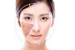 激素臉怎么治？激素臉怎么調(diào)理？[多圖]