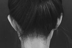 后腦勺痛是什么原因？后腦勺痛怎么快速緩解？[多圖]
