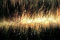 發(fā)根有白色顆粒怎么辦？發(fā)根的白點是怎么回事？[多圖]