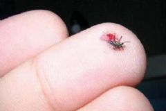 蚊子在吸血的時候打死會怎樣？蚊子吸血的時候打死好嗎？[多圖]