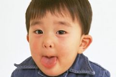 舌苔發(fā)黃是什么原因？舌苔發(fā)黃是怎么回事？[多圖]