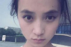 青少年有黑眼圈怎么辦？青少年黑眼圈怎么祛除？[多圖]