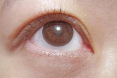 春天眼睛發(fā)癢怎么回事？春天眼睛發(fā)癢怎么辦？[多圖]