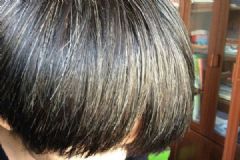 16歲為什么有白頭發(fā)？16歲長白頭發(fā)是什么原因？[多圖]