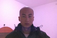 男性脫發(fā)是腎虛嗎？男性脫發(fā)與腎有何關(guān)聯(lián)？[多圖]