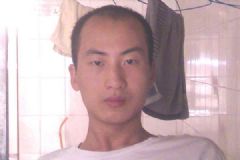 男性脫發(fā)是什么原因？男性脫發(fā)是什么引起的？[多圖]