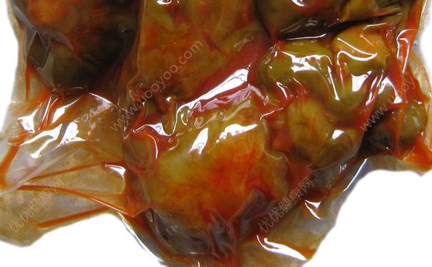 吃榨菜會長胖嗎？榨菜吃多了會胖嗎？(2)