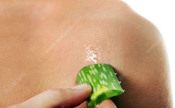 夏季皮膚曬傷后怎么辦？皮膚曬傷后如何應急處理？(3)