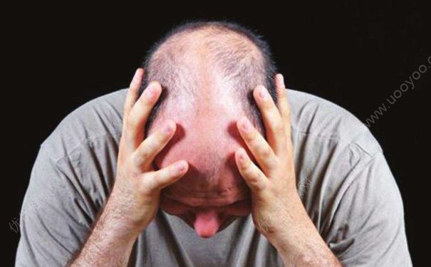 男性脫發(fā)是為什么？怎么預(yù)防男性脫發(fā)？(1)