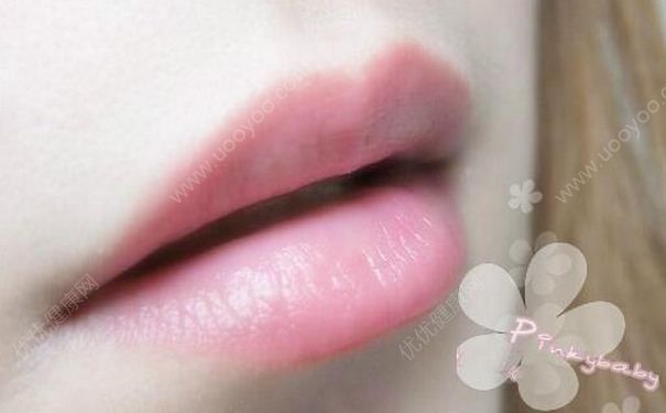 嘴唇干裂是什么原因？為什么嘴唇會(huì)干裂？(1)