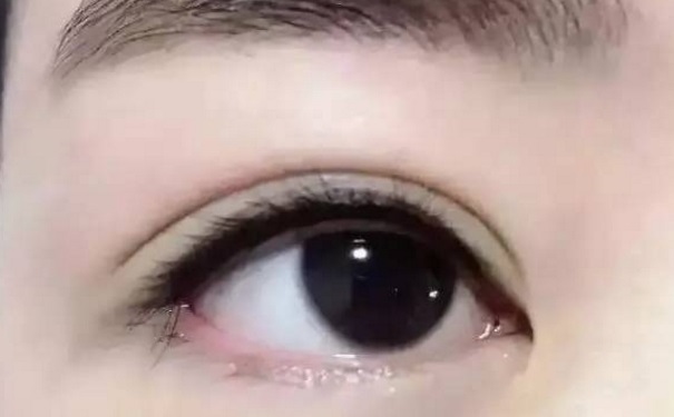 美瞳線對(duì)眼睛有什么壞處？美瞳線對(duì)眼睛有副作用嗎？(1)