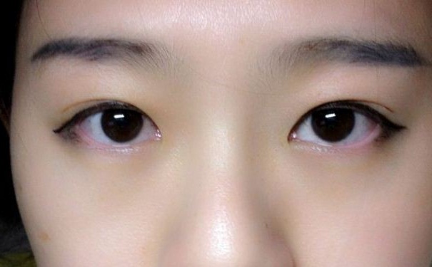 哪些美瞳比較流行？初戴有哪些美瞳注意事項？(1)