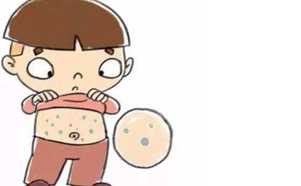 小孩起水痘怎么辦？小孩起水痘要注意什么？(1)