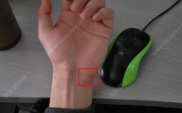 白領(lǐng)經(jīng)常會患哪些電腦??？患了鼠標(biāo)手該如何處理？(1)