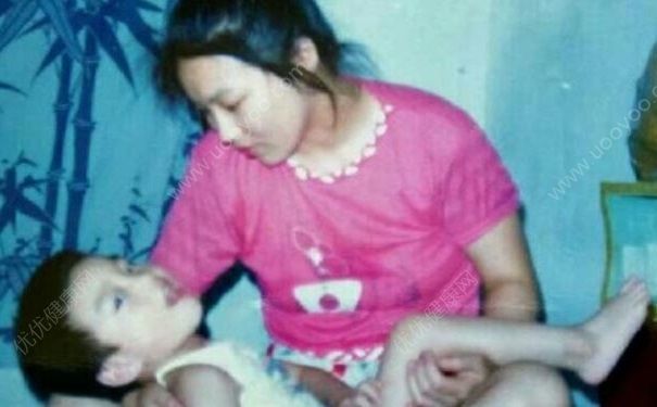 重度腦癱兒子進哈佛，腦癱是一種什么?。?3)