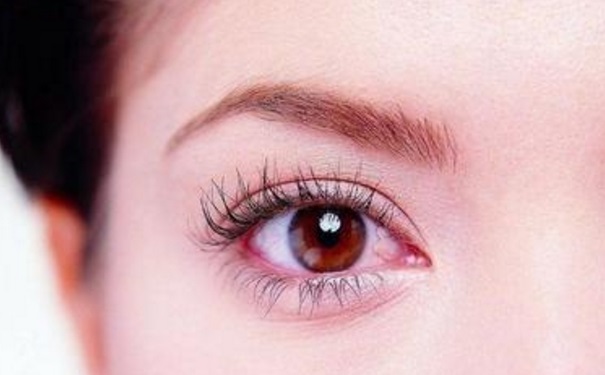 眼睛有紅血絲怎么調(diào)理？眼睛有紅血絲怎么快速消掉？(1)