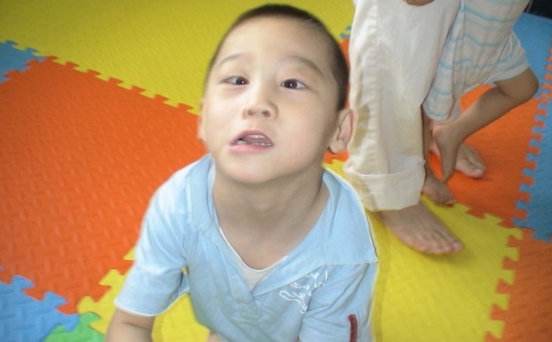 輕度腦癱是什么疾?。枯p度腦癱的癥狀是什么？(1)