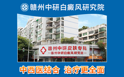 去贛州中研皮膚病專科怎么走？斑禿是什么原因造成的？