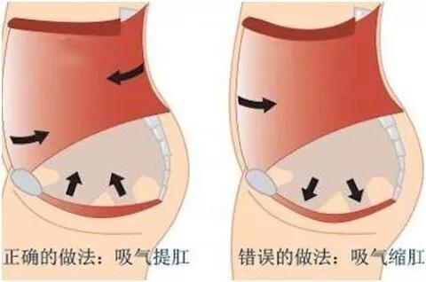 西安東大肛腸醫(yī)院揭秘：一項(xiàng)神奇的運(yùn)動(dòng)保護(hù)你的小菊花