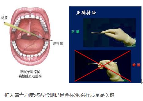 核酸檢測(cè)新冠病毒的常用手段：口腔拭子、鼻腔拭子檢測(cè)圖解