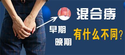 混合痔早期和晚期有什么不同？昆明東大肛腸醫(yī)院教你分辨