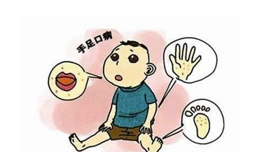 手足口病可以吃芒果嗎？手足口病吃芒果要注意什么？