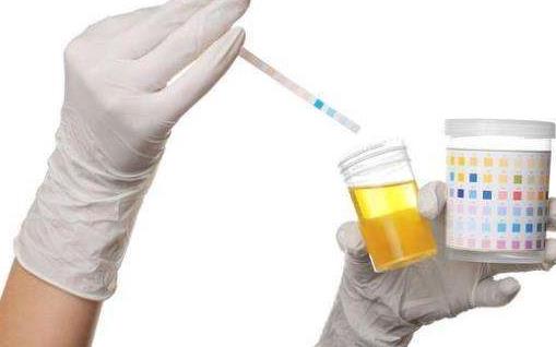 尿酸高有哪些癥狀？尿酸偏高有哪些原因？