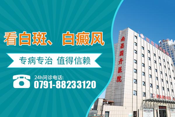 南昌國丹醫(yī)院治療白癜風(fēng)怎么樣，身上有白色的斑點是怎么回事？